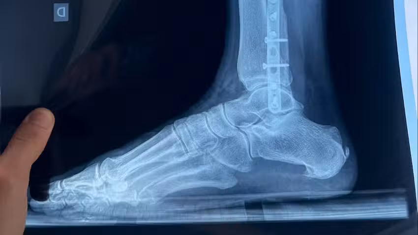 PNI, Entrenamiento Personal y Readaptación de lesiones.